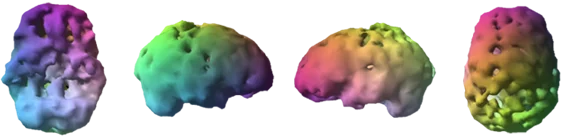 Unhealthy Brain Scan